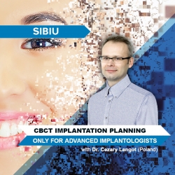 CBCT Implantation Planning (Only for Advanced Implantologists)