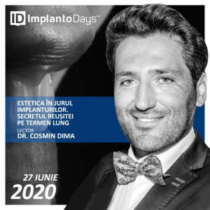 Estetica în jurul implanturilor. Totul de la A la Z.