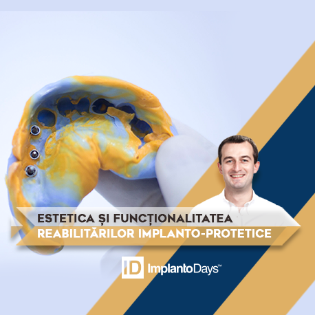 ESTETICA ȘI FUNCȚIONALITATEA REABILITĂRILOR IMPLANTO-PROTETICE ESTETICA ȘI FUNCȚIONALITATEA REABILITĂRILOR IMPLANTO-PROTETICE