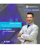 Sinus lifting. Totul, de la anatomia detaliată, la cazuri clinice foarte complexe.