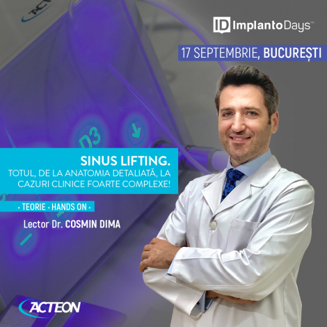 Sinus lifting. Totul, de la anatomia detaliată, la cazuri clinice foarte complexe. Sinus lifting. Totul, de la anatomia detaliată, la cazuri clinice foarte complexe.