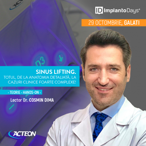 Sinus lifting. Totul, de la anatomia detaliată, la cazuri clinice foarte complexe. Sinus lifting. Totul, de la anatomia detaliată, la cazuri clinice foarte complexe.