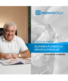 Elevarea planșeului sinusului maxilar prin acces lateral