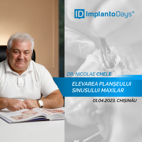 Elevarea planșeului sinusului maxilar prin acces lateral Elevarea planșeului sinusului maxilar prin acces lateral