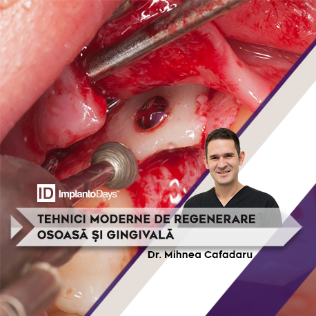 TEHNICI MODERNE DE REGENERARE OSOASĂ ȘI GINGIVALĂ TEHNICI MODERNE DE REGENERARE OSOASĂ ȘI GINGIVALĂ